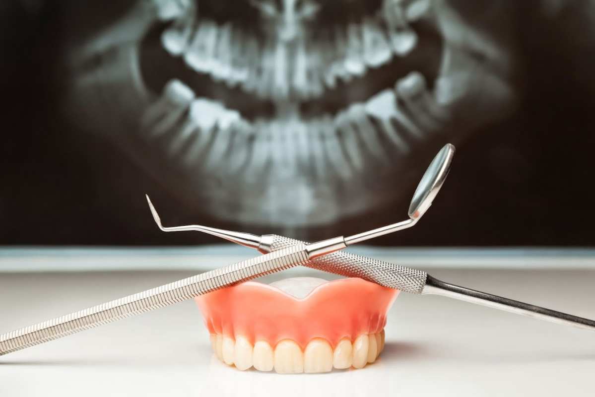 Открытка рентген челюсти  с днем стоматолога   З днем ​​стоматолога 